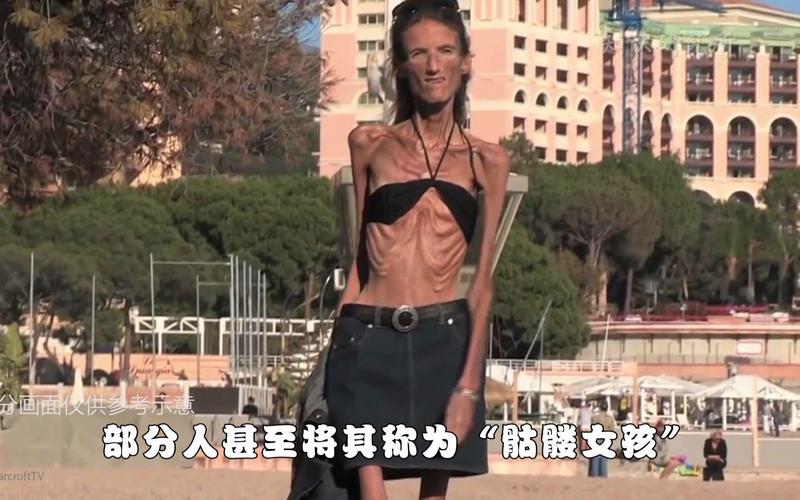 15岁少女为爱减肥去世,近50天不吃东西,体重仅24.8公斤