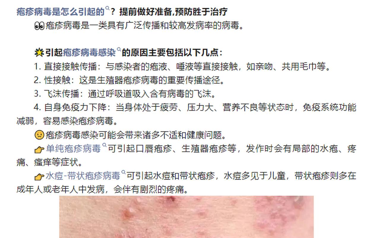 你以为疱疹病毒1型感染只引起小溃疡?Brain Pathol研究发现它还会捣乱Tau蛋白,诱发阿尔茨海默病!